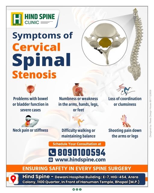 Cervical spinal stenosis symptoms diagram